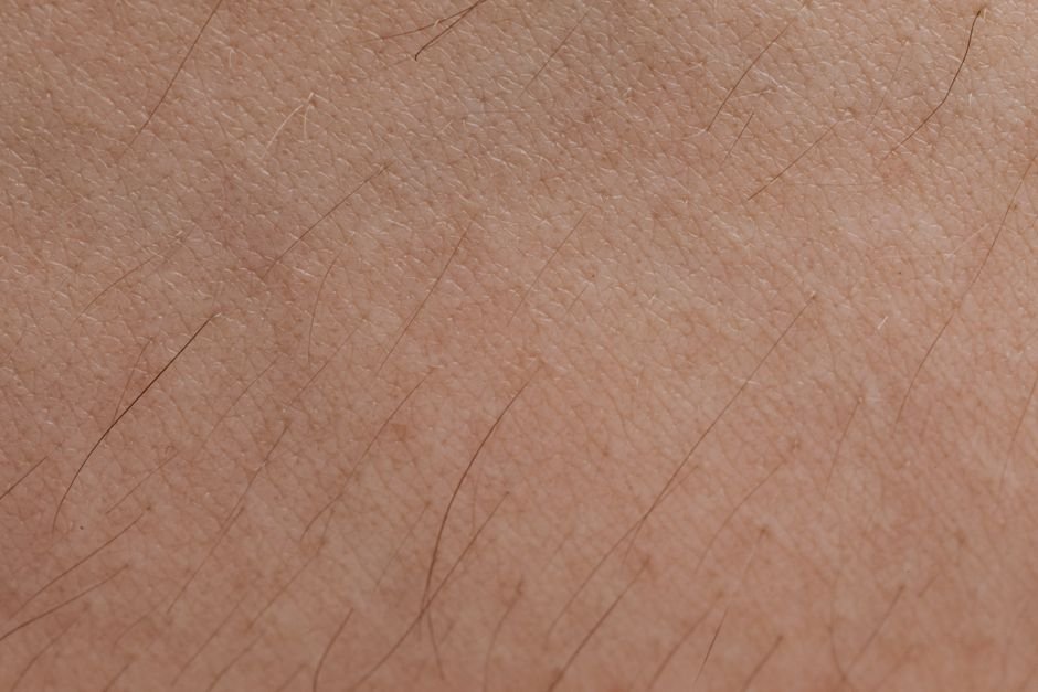 Epiderme